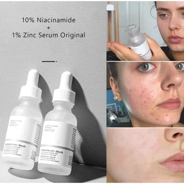 The Ordinary – Niacinamide 10% + Zinc 1% – 30ml – For Beauty Scan